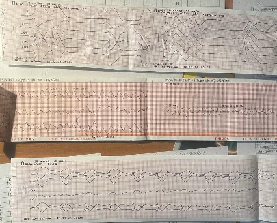 Лікарі екстренки врятували 75-річну харків’янку з інфарктом 