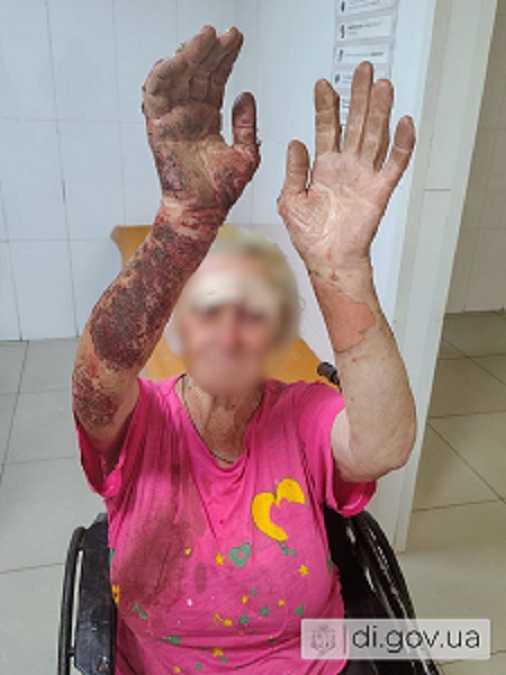 Три жінки постраждали на Харківщині через ворожі обстріли
