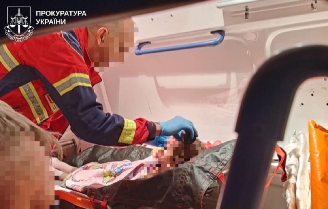 Серед поранених після ударів рф по Харківщині — 6-річна дитина