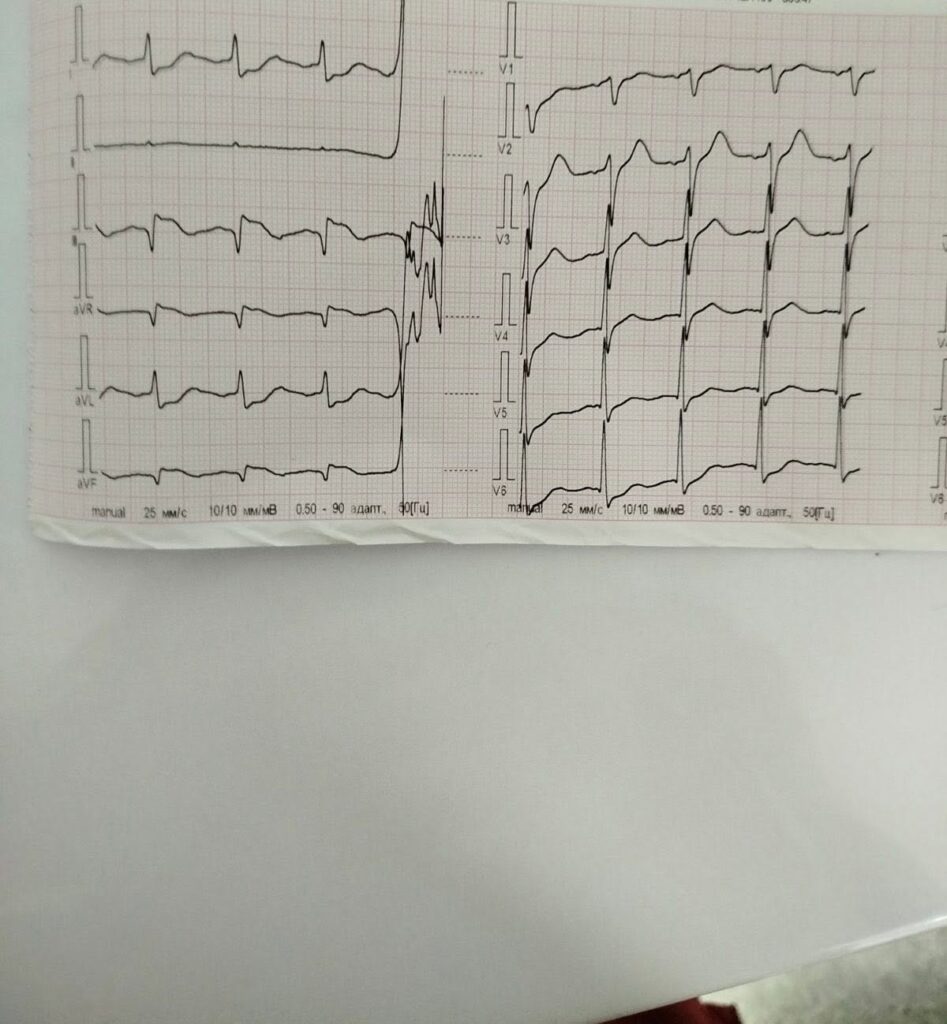 У Харкові медики швидкої вдруге врятували життя чоловіку