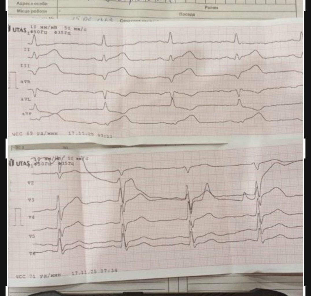 У Харкові медики швидкої вдруге врятували життя чоловіку