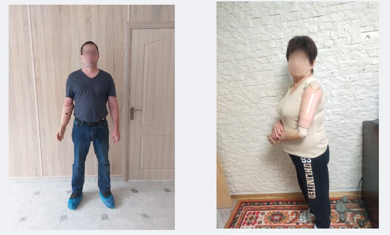 Жителі Харківщини отримали протези в межах міжнародної співпраці