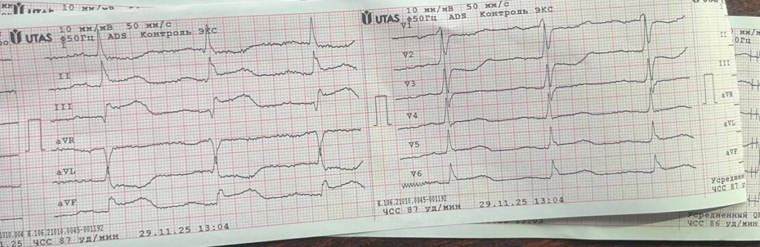 Харківські медики реанімували жінку з інфарктом (фото)