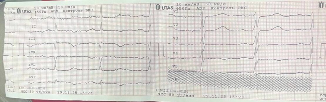 Харківські медики реанімували жінку з інфарктом (фото)