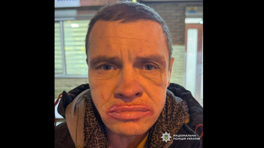 Розшукується чоловік, який скоїв напад на поліцейського