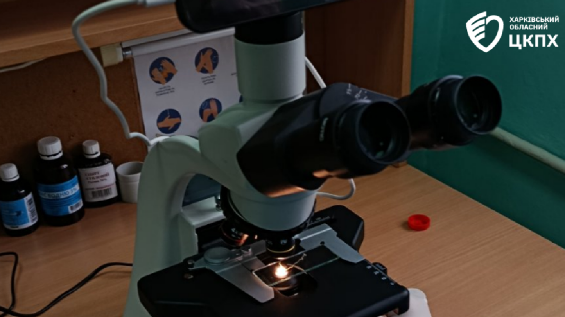 З гомілки харків’янки дістали 10-сантиметрового паразита