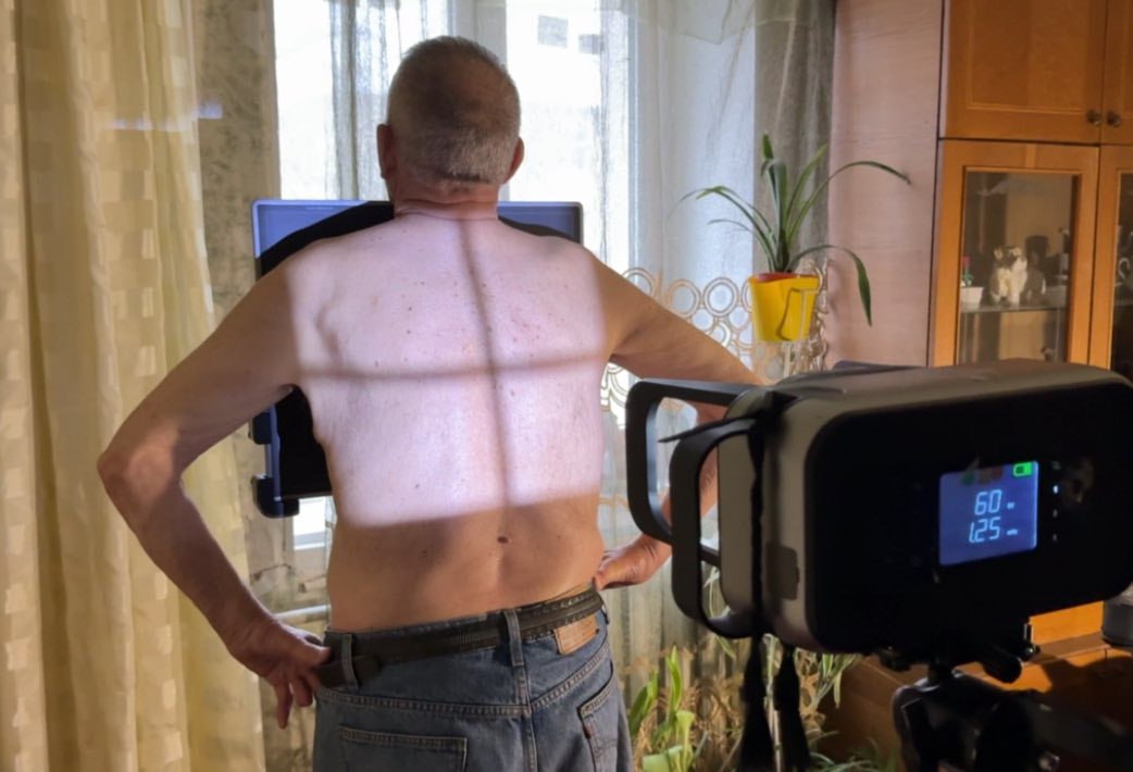 У Харкові відновили виїзні медичні огляди для ВПО